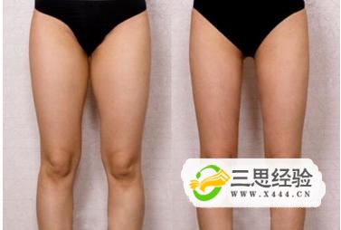 <b>瘦大腿减肥方法-瘦大腿最科学的方法</b>